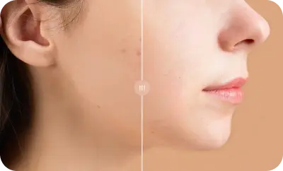 Ecommerce Product Use Comaprison Image